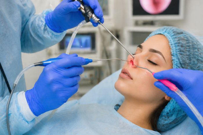 Functional Endoscopic Sinus Surgery