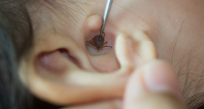 Foreign Bodies in the Ear