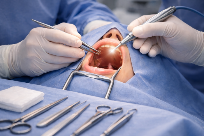 Throat Surgery