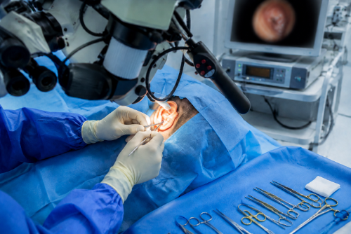 Tympanoplasty Treatment